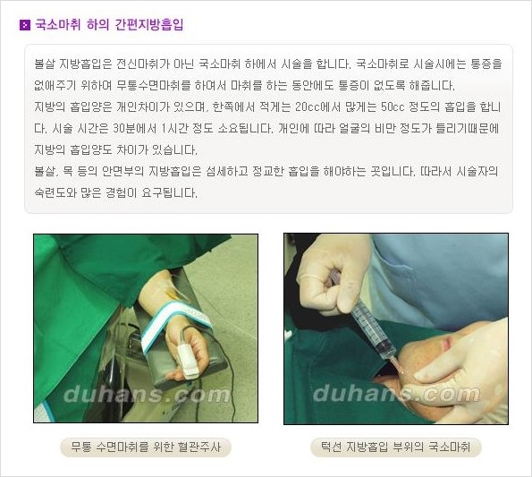 [두한성형외과 경쟁력 얼굴 미세지방흡입] - [볼살, 턱선 지방흡입 안내] 관련 이미지 2