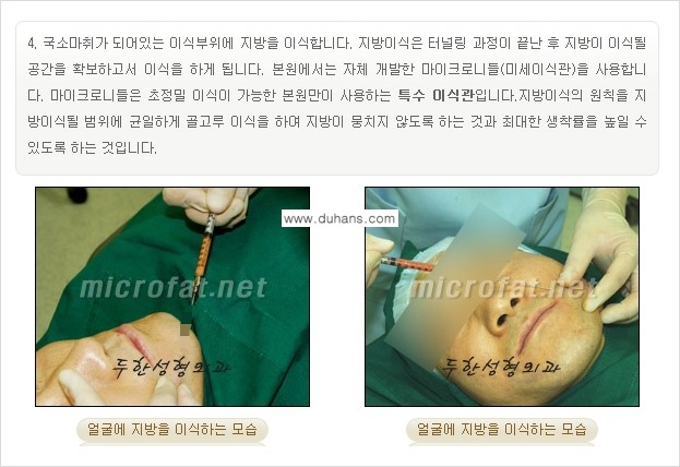 [두한성형외과 "미세지방이식"] - [지방이식 부작용 교정 정보 ②] 관련 이미지 9
