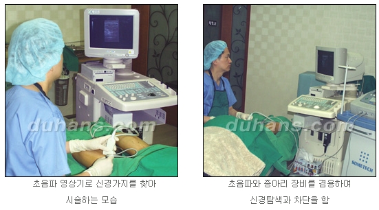 [두한성형외과 종아리축소술] - [초음파 유도 선택적 신경차단술 안내] 관련 이미지 12