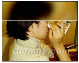 [DuHan Plastic Surgery Scar] - [DHL Simple Scar Treatment] image 7