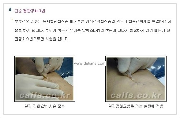 [두한성형외과 경쟁력 멀티종아리성형] - [나에게 맞는 종아리성형 방법의 종류 안내 3.] 관련 이미지 10