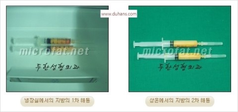 ⁠⁠⁠﻿﻿[두한성형외과 경쟁력 미세지방이식] - [두한 자가지방이식 클리닉의 특징] 관련 이미지 12