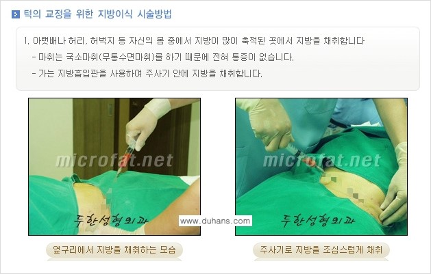 [두한성형외과의 경쟁력 미세지방이식] - [무턱교정 - 턱 미세지방이식 안내 1.] 관련 이미지 9