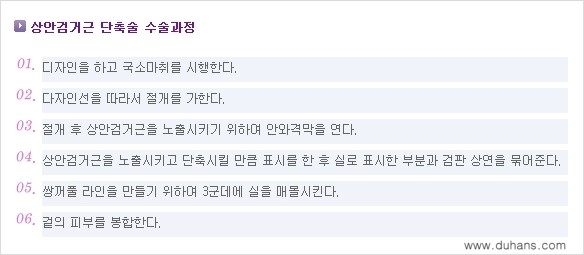 [두한성형외과 경쟁력 눈성형] - [안검하수 수술 방법] 관련 이미지 1
