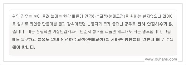 [두한성형외과 경쟁력 쌍꺼풀 재수술(극한 재수술)] - [안검하수(졸리운 눈매) 교정 안내 1.] 관련 이미지 7