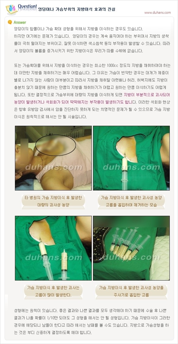 [두한성형외과 경쟁력 지방이식] - [지방이식의 잘못된 지식] 관련 이미지 4