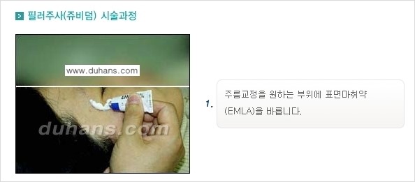 [두한성형외과 젊어지는 주름교정술] - [주름제거 시술방법 ④] 관련 이미지 4
