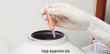 [눈밑수술 두한성형외과] - [다크서클 콤비프로그램] 관련 이미지 48