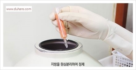 [두한성형외과 경쟁력 눈밑성형] - [다크써클 수술 동시 콤비 프로그램 안내] 관련 이미지 9