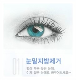 ⁠⁠[두한성형외과 경쟁력 눈밑성형] - [무흉터 눈밑 지방제거 안내] 관련 이미지 21