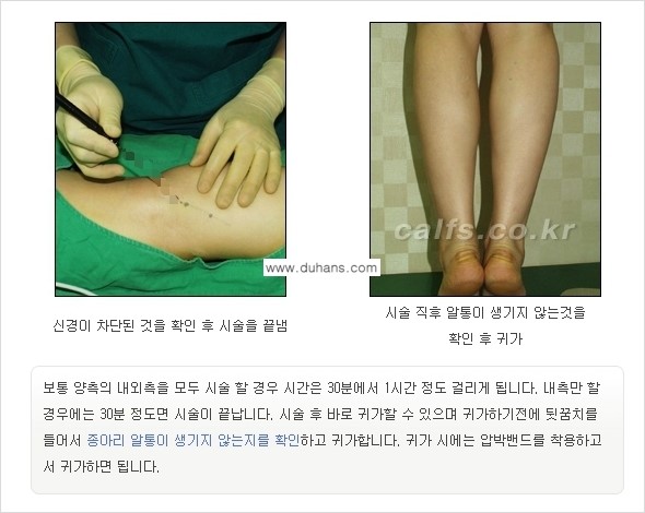 ​[두한성형외과와 날씬한 종아리 만들기!] - [간편하고 안전한 종아리 축소방법 ②] 관련 이미지 14