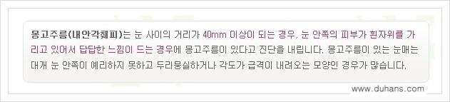 [두한성형외과 경쟁력 눈성형] - [몽고주름 제거수술, 앞트임 수술 안내] 관련 이미지 2