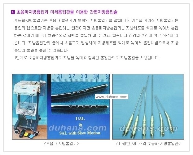 [두한성형외과 경쟁력 초음파 간편지방흡입] - [복부지방흡입, 허벅지지방흡입, 엉덩이지방흡입, 팔뚝지방흡입 안내] 관련 이미지 7
