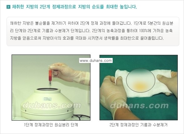 [두한성형외과 NO.1 지방이식]-[두한 지방이식 클리닉의 특징] 관련 이미지 8