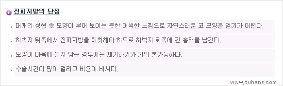 [두한성형외과 경쟁력 코성형] - [여러 가지 코성형 방법 안내] 관련 이미지 15