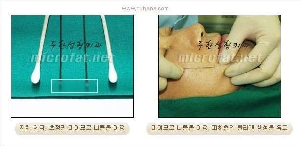 [두한성형외과 경쟁력 눈밑성형] - [눈밑 다크써클 치료에 대한 자주하는 질문과 답변 모음 안내] 관련 이미지 2