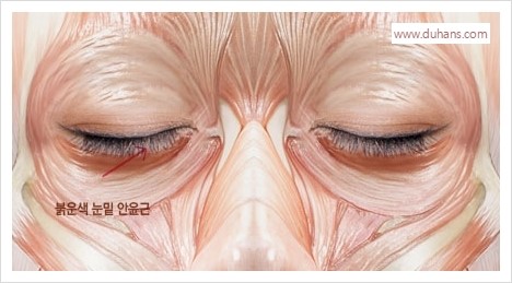 [두한성형외과 경쟁력 눈밑성형] - [다크써클 치료 실패의 원인 - 레이저 치료, 필러로 교정, 잘못된 적응증의 지방재배치] 관련 이미지 2