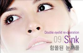 [Duhan Plastic Surgery Double Eyelid Revision] - [Thick Double Eyelid Line] image 73
