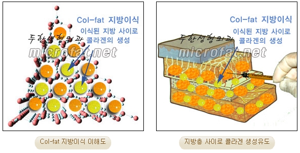 Fat Grafting Leader Duhan Plastic Surgery - Everything About Fat Grafting image 3