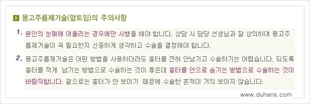 [두한성형외과 경쟁력 눈성형] - [앞트임 수술(몽고주름 제거) 안내 ②] 관련 이미지 9