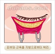 [두한성형외과 경쟁력 동안성형 리더] - ​[미간주름, 이마주름, 안검성형, 이마거상술, 눈썹거상술] 관련 이미지 61