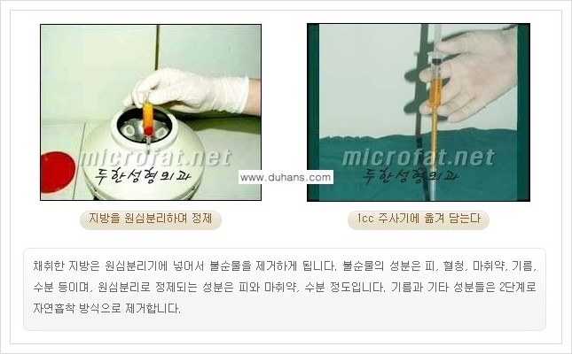 [두한성형외과 경쟁력 눈밑성형] - [눈밑 다크써클, 눈밑 주름의 교정 안내 1.] 관련 이미지 11