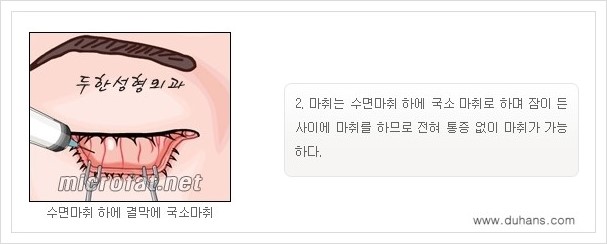 [두한성형외과 경쟁력 눈밑성형] - [눈밑지방제거, 눈위지방제거 안내 1.] 관련 이미지 6