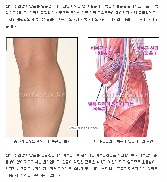 [두한성형외과 경쟁력 있는 종아리성형] - [초음파 유도 신경차단술 1.] 관련 이미지 9