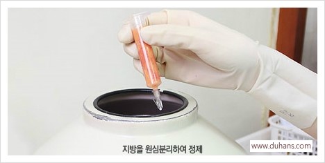 ​[두한성형외과 경쟁력 눈밑성형 리더] - [눈밑 다크써클의 증상, 원인, 종류, 치료방법 안내] 관련 이미지 9