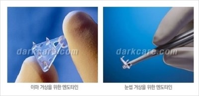 [두한성형외과 경쟁력 동안성형 리더] - ​[미간주름, 이마주름, 안검성형, 이마거상술, 눈썹거상술] 관련 이미지 125