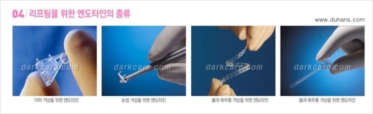 ​[두한성형외과 무한 경쟁력 다크써클 치료] - [다크써클 + 리프팅(엔도타인) 콤비 프로그램] 관련 이미지 4