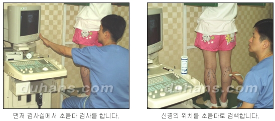 [두한성형외과 종아리 퇴축] - [종아리 퇴축술 재발 재수술] 관련 이미지 4