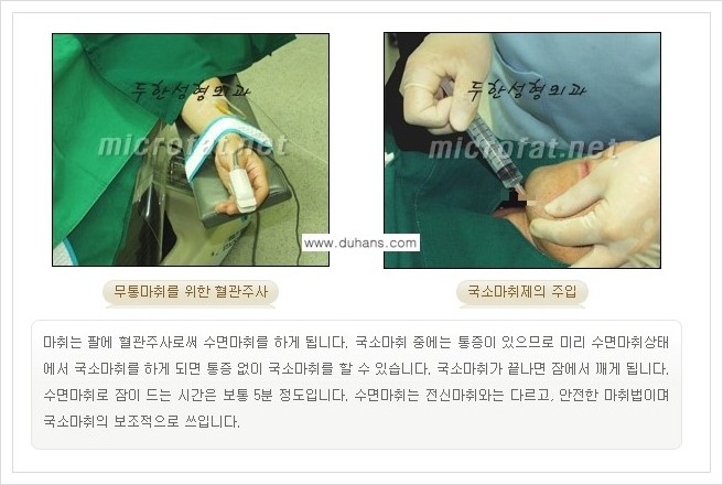 [두한성형외과 경쟁력 얼굴지방흡입] - [통통한 볼살, 두툼한 턱살(턱선)의 지방흡입] 관련 이미지 8