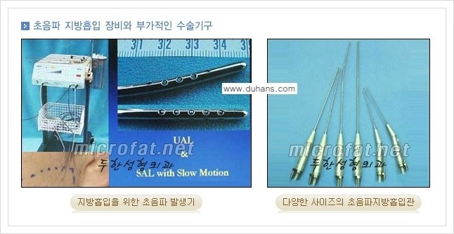 [두한성형외과 경쟁력 얼굴지방흡입] - [통통한 볼살, 두툼한 턱살(턱선)의 지방흡입] 관련 이미지 5