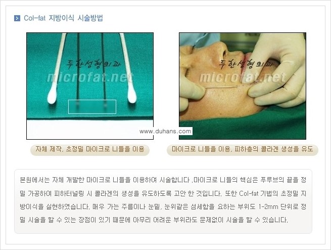[두한성형외과 경쟁력 미세지방이식] - [상표등록 "Col-fat(콜펫) 지방이식"의 장점 안내] 관련 이미지 2