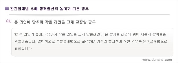 [두한성형외과 경쟁력 쌍꺼풀 재수술] - [비대칭(짝짝이) 쌍꺼풀 라인 교정하는 방법 안내 ①] 관련 이미지 5