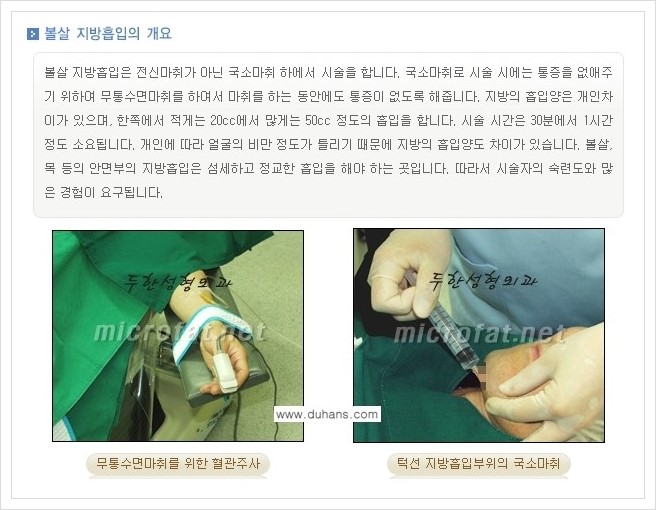 [두한성형외과 경쟁력 얼굴지방흡입] - [통통한 볼살, 두툼한 턱살(턱선)의 지방흡입] 관련 이미지 3
