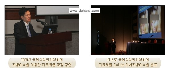 [두한성형외과 상표특허 "Col-fat(콜펫) 지방이식"] - [Col-fat(콜펫) 지방이식이란?] 관련 이미지 3