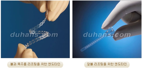 두한성형외과 안티에이징 리프팅 - 엔도타인 리프팅 관련 이미지 5