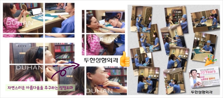 DuHan Plastic Surgery Revision Rhinoplasty - AlloDerm Nose Surgery, SureDerm Nose Surgery image 18