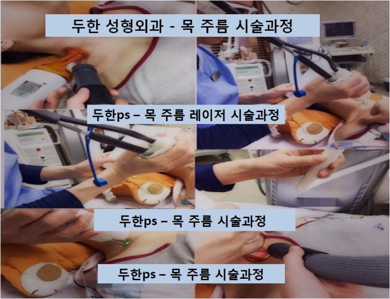 [두한성형외과 목주름]-[#목주름레이저 #목주름 #주름개선레이저 #주름교정] 관련 이미지 2