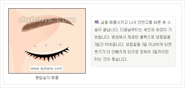 [두한성형외과 경쟁력 눈성형, 쌍꺼풀 수술] - [퀵쌍꺼풀(부분절개법)의 수술 안내] 관련 이미지 11