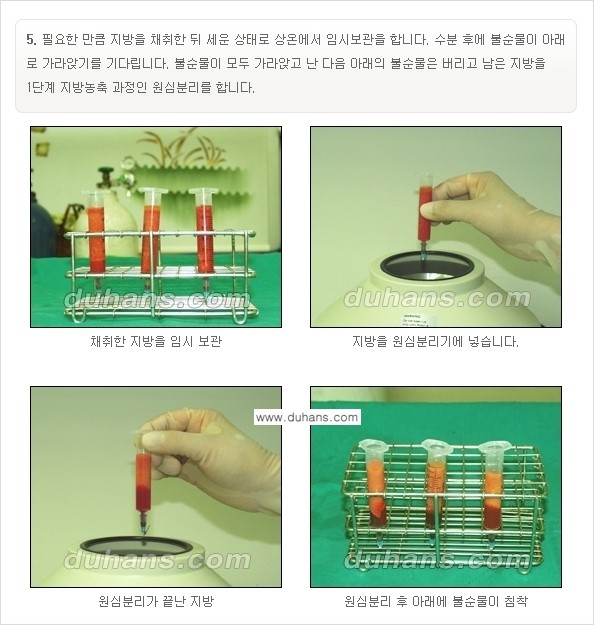 [두한성형외과 경쟁력 미세지방이식] - [부드럽고 아름다운 얼굴선 얼굴 미세지방이식 과정] 관련 이미지 5