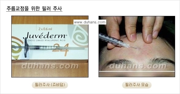 [두한성형외과 젊어지는 주름교정술] - [주름제거 시술방법 ③] 관련 이미지 2
