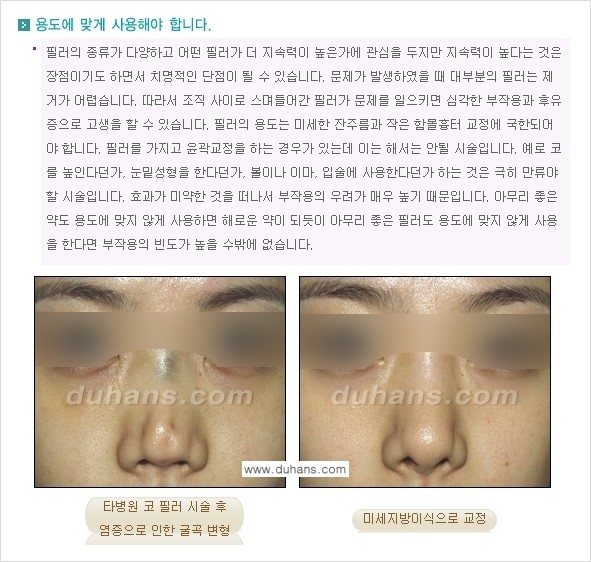 [두한성형외과 간단 주사요법] - [필러에 대하여 올바로 알아야 할 지식 안내] 관련 이미지 3