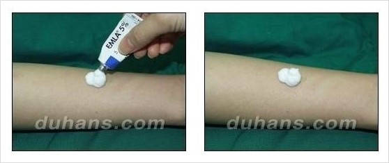 [두한성형외과 안전 제일 성형] - [통증 없는 마취 - 무통 수면마취] 관련 이미지 5