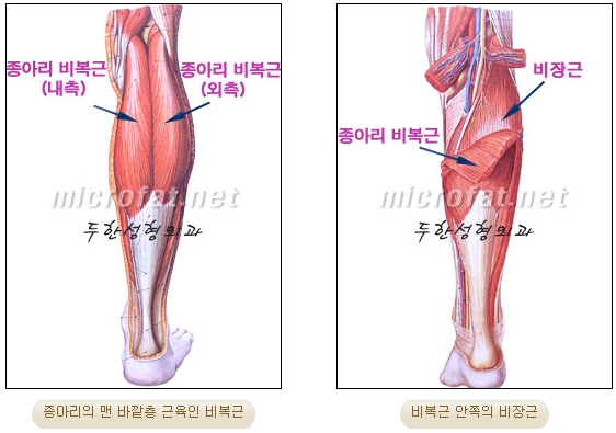 [Duhan Plastic Surgery Clinic Calf Contouring] - [Calf Reduction] image 4