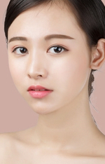 [두한성형외과 얼굴자가지방이식] - [귀족수술 입체 미세지방이식] 관련 이미지 1