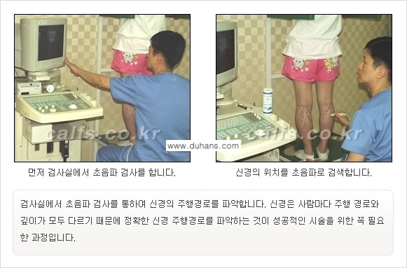 [두한성형외과 경쟁력 종아리성형] - [초음파 유도 선택적 신경차단술 안내 ②] 관련 이미지 4