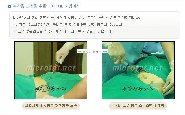 [두한성형외과 "미세지방이식"] - [지방이식 부작용 교정 정보 ②] 관련 이미지 6